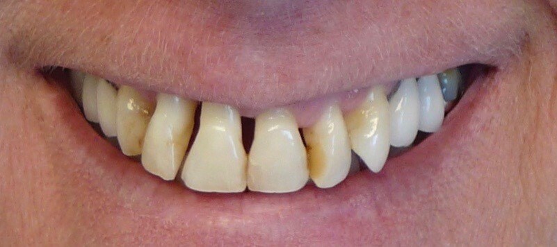 Before Image