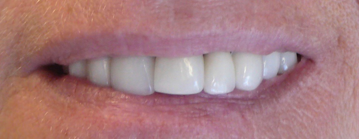 After Image
