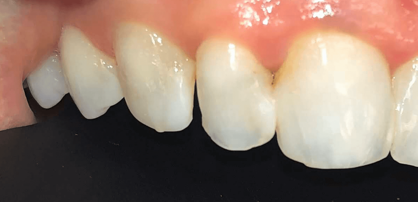 Before Image