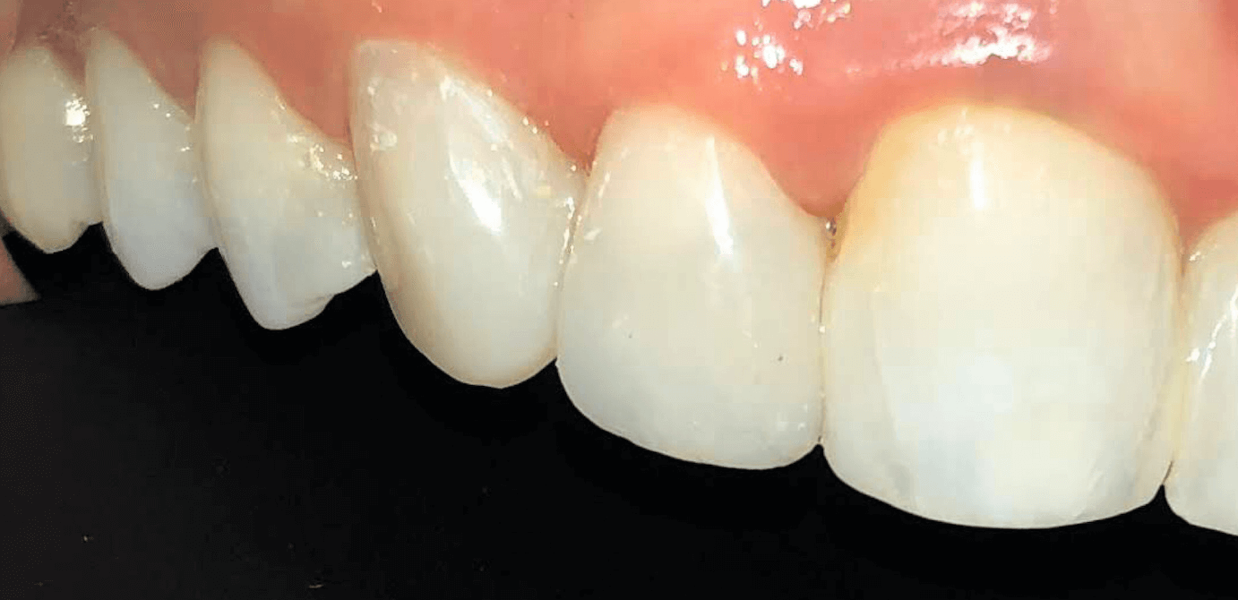 After Image