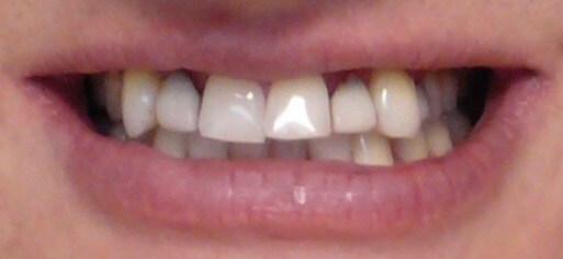 Before Image