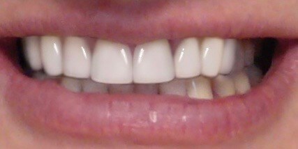 After Image