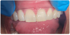 After Image