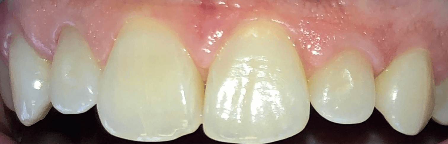 Before Image